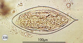  Virile Vitellariasis: A Peek into the Lives of These Tiny Trematodes